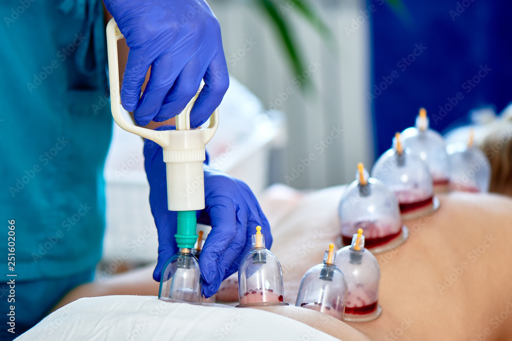 Cup4Sunnah - Cupping (Hijama) Clinic & Spinal Alignment | Acupuncture | Pain Management — photo 4